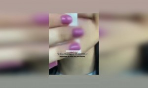 पिम्पल्स भगायो